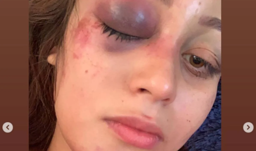 «Si no lograba escaparme, quizás ya no estuviera viva», joven denuncia en redes agresiones de su expareja